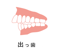 出っ歯