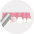 歯の表面をツルツルに仕上げ磨き