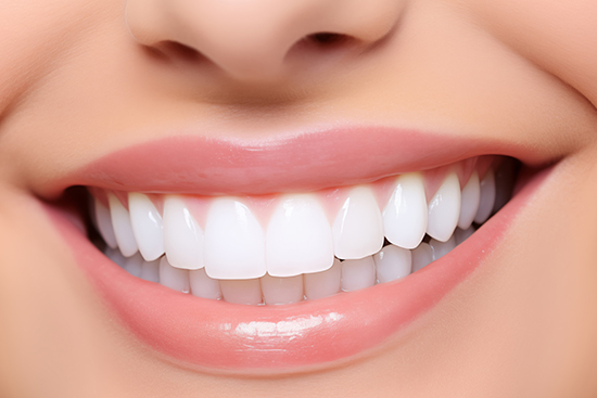 矯正により歯並びが綺麗になった女性