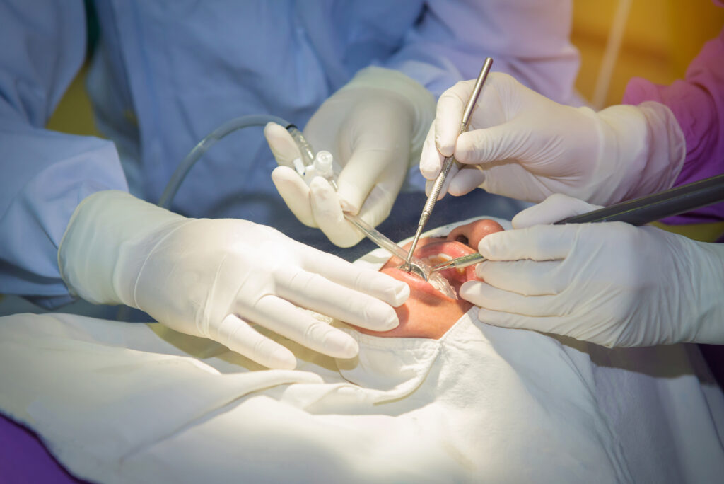 口腔外科での手術の様子