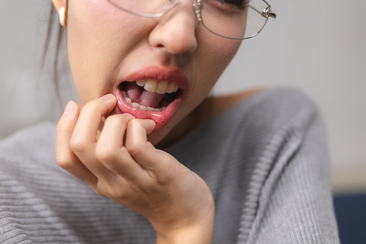 舌痛症になった女性